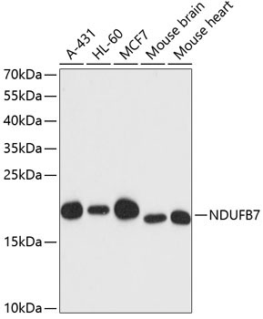 NDUFB7 Rabbit Polyclonal Antibody