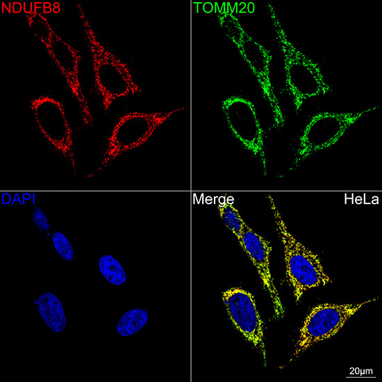 NDUFB8 Rabbit Monoclonal Antibody - Image 10