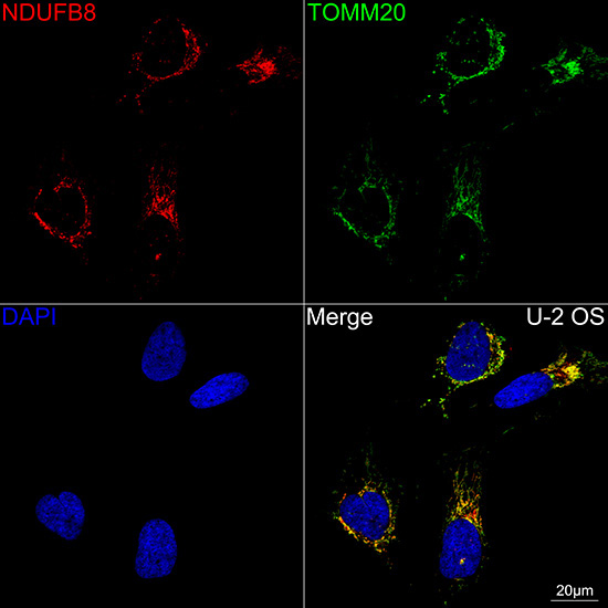 NDUFB8 Rabbit Monoclonal Antibody - Image 11