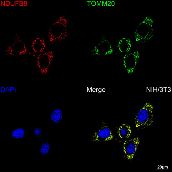 NDUFB8 Rabbit Monoclonal Antibody - Image 12