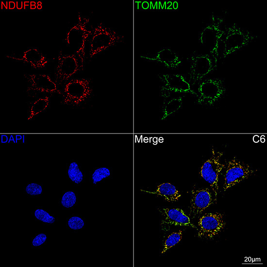 NDUFB8 Rabbit Monoclonal Antibody - Image 13