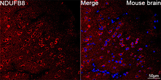 NDUFB8 Rabbit Monoclonal Antibody - Image 14