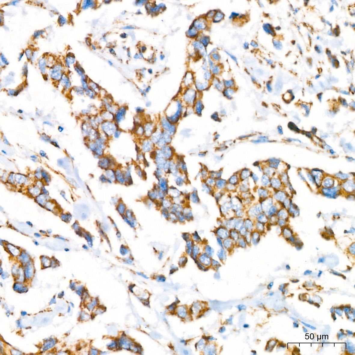 NDUFB8 Rabbit Monoclonal Antibody - Image 3