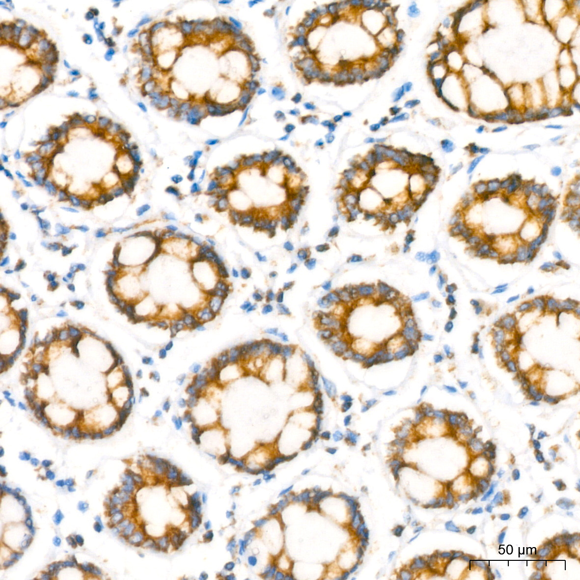 NDUFB8 Rabbit Monoclonal Antibody - Image 4