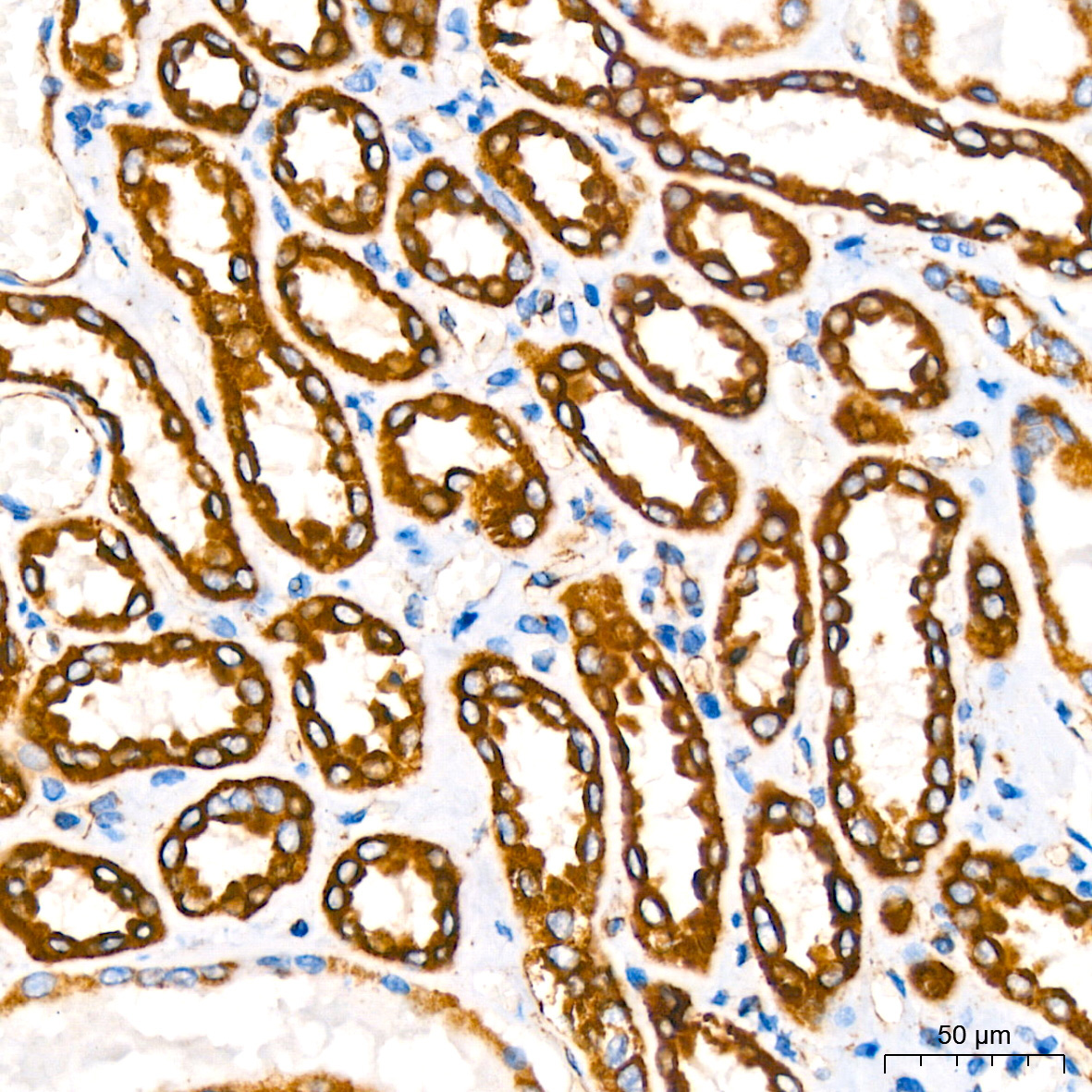 NDUFB8 Rabbit Monoclonal Antibody - Image 5