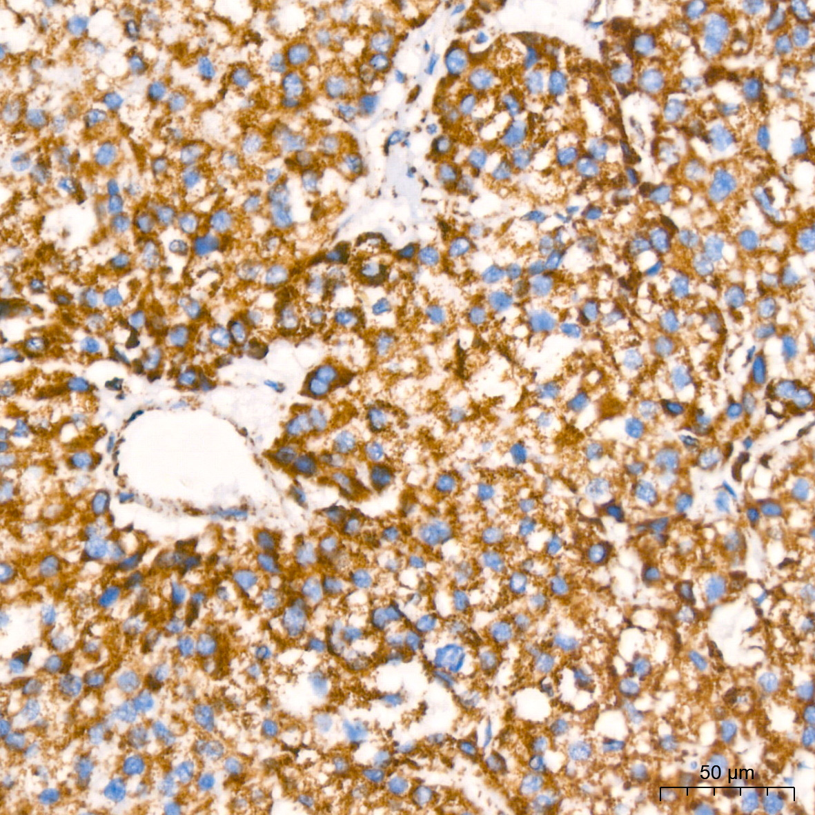 NDUFB8 Rabbit Monoclonal Antibody - Image 6