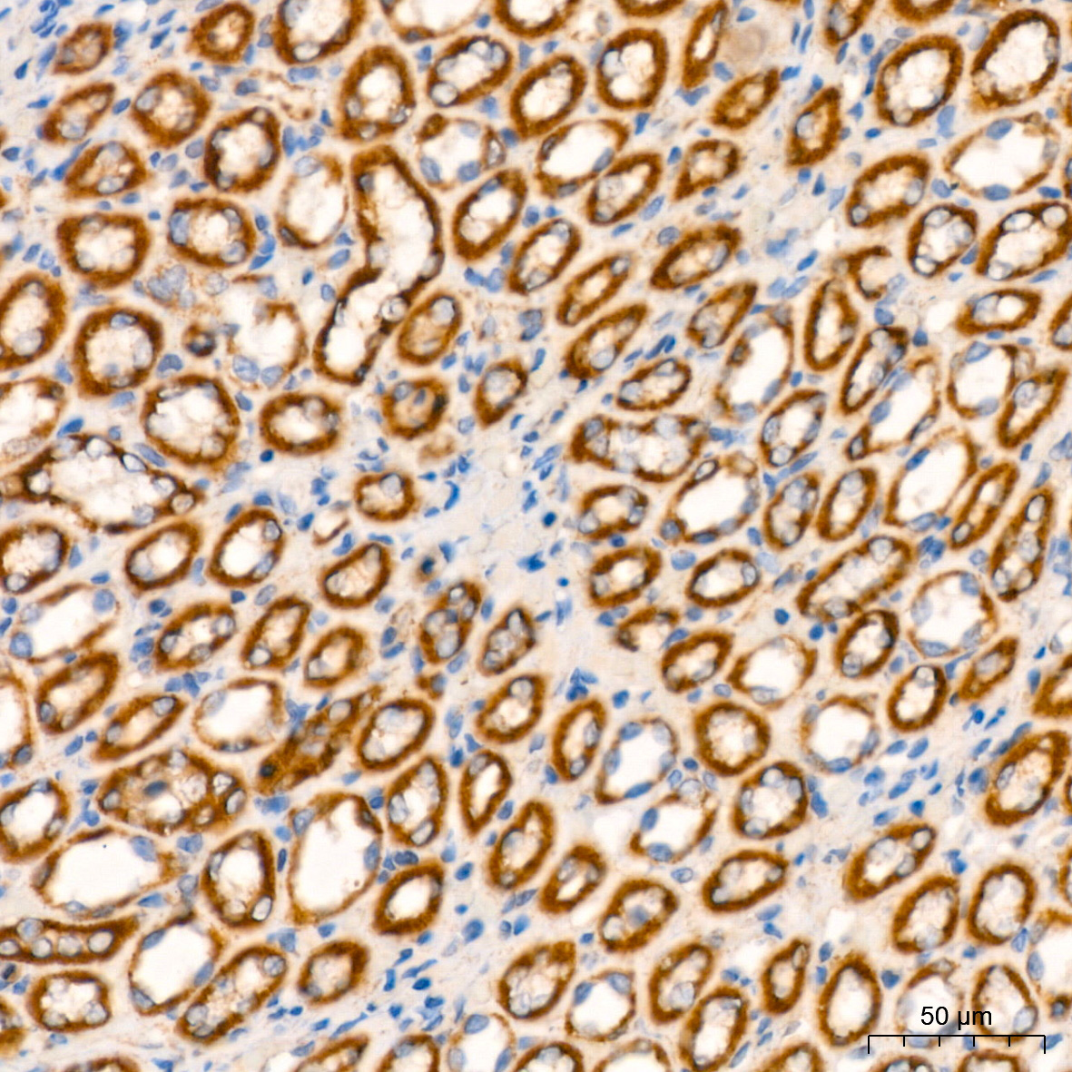 NDUFB8 Rabbit Monoclonal Antibody - Image 8