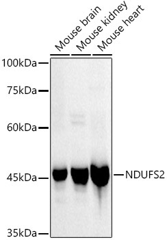 NDUFS2 Rabbit Monoclonal Antibody - Image 2