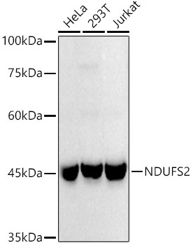 NDUFS2 Rabbit Monoclonal Antibody - Image 3