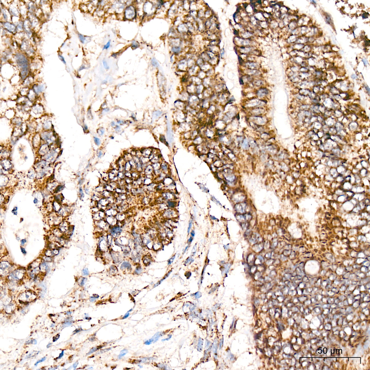 NDUFS4 Rabbit Monoclonal Antibody - Image 4