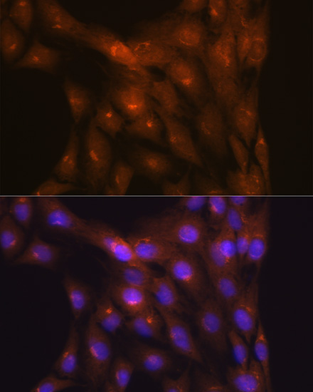 NDUFS4 Rabbit Monoclonal Antibody - Image 5