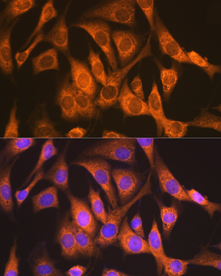 NDUFS4 Rabbit Monoclonal Antibody - Image 6