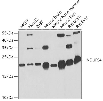 NDUFS4 Rabbit Polyclonal Antibody