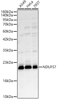 NDUFS7 Rabbit Polyclonal Antibody