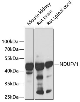 NDUFV1 Rabbit Polyclonal Antibody