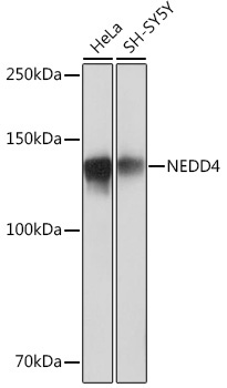 NEDD4 Rabbit Monoclonal Antibody