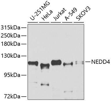 NEDD4 Rabbit Polyclonal Antibody