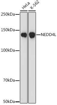 NEDD4L Rabbit Monoclonal Antibody