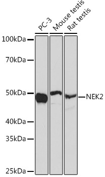 NEK2 Rabbit Monoclonal Antibody