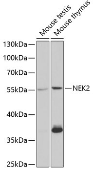 NEK2 Rabbit Polyclonal Antibody