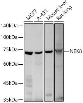 NEK8 Rabbit Polyclonal Antibody