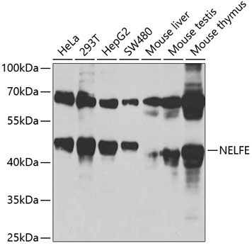 NELFE Rabbit Polyclonal Antibody