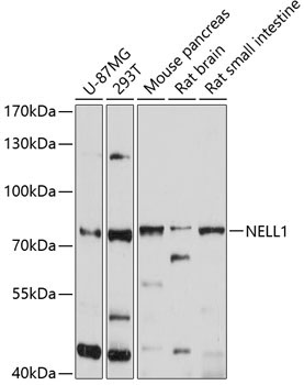NELL1 Rabbit Polyclonal Antibody