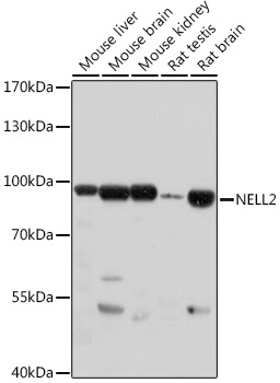 NELL2 Rabbit Polyclonal Antibody