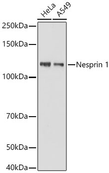 Nesprin 1 Rabbit Monoclonal Antibody