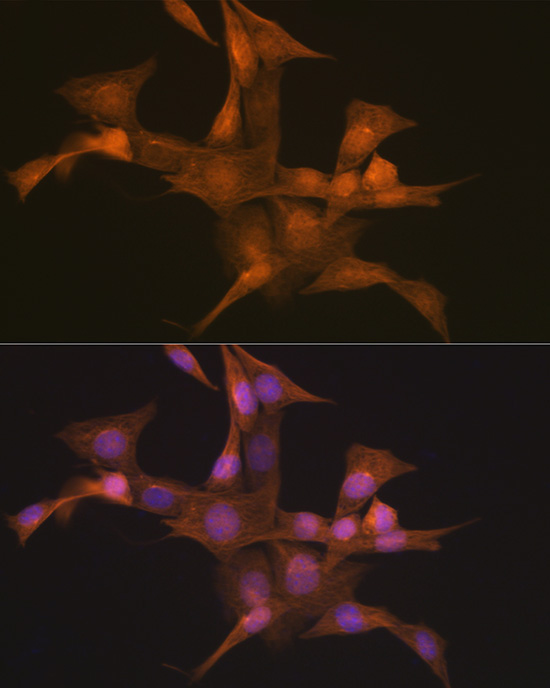 Nesprin 1 Rabbit Monoclonal Antibody - Image 2
