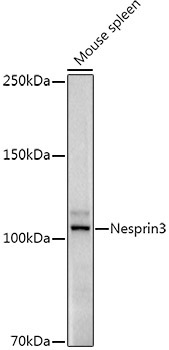 Nesprin3 Rabbit Monoclonal Antibody - Image 2