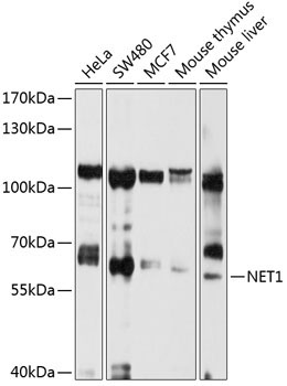 NET1 Rabbit Polyclonal Antibody