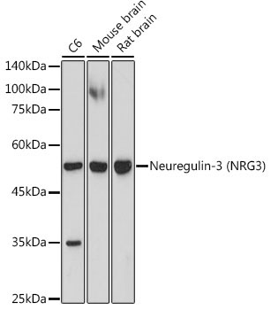 Neuregulin-3 (NRG3) Rabbit Monoclonal Antibody - Image 2