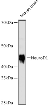 NeuroD1 Rabbit Monoclonal Antibody