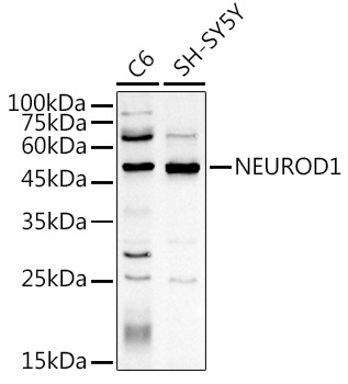 NEUROD1 Rabbit Polyclonal Antibody