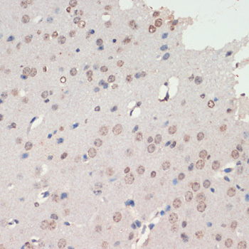 NEUROD1 Rabbit Polyclonal Antibody