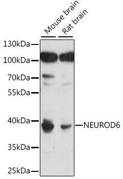 NEUROD6 Rabbit Polyclonal Antibody