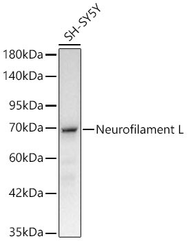 Neurofilament L Rabbit Monoclonal Antibody