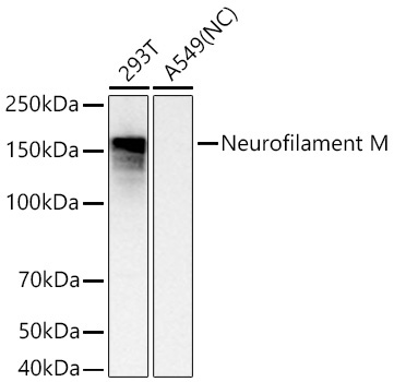 Neurofilament M Rabbit Monoclonal Antibody