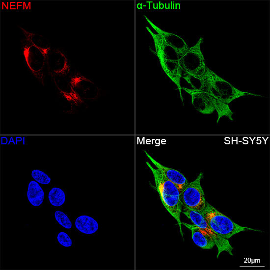 Neurofilament M Rabbit Monoclonal Antibody - Image 2