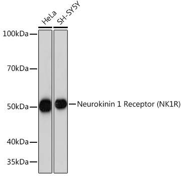 Neurokinin 1 Receptor (NK1R) Rabbit Monoclonal Antibody