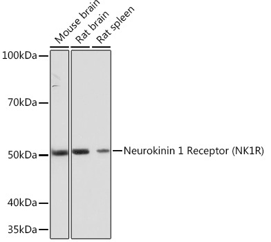 Neurokinin 1 Receptor (NK1R) Rabbit Monoclonal Antibody - Image 2