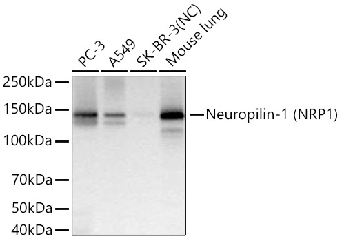 Neuropilin-1 (NRP1) Rabbit Monoclonal Antibody
