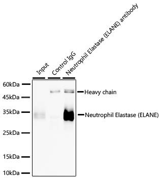 Neutrophil Elastase (ELANE) Rabbit Monoclonal Antibody - Image 2