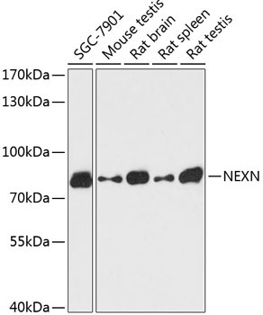 NEXN Rabbit Polyclonal Antibody