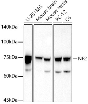 NF2 Rabbit Polyclonal Antibody