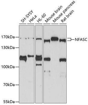NFASC Rabbit Polyclonal Antibody