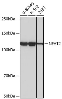 NFAT2 Rabbit Monoclonal Antibody