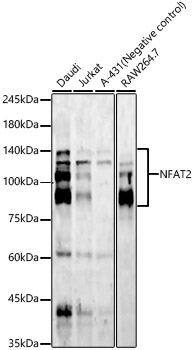 NFAT2 Rabbit Monoclonal Antibody