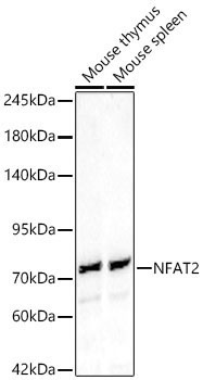NFAT2 Rabbit Polyclonal Antibody
